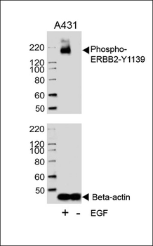 Phospho-ERBB2(Y1139) Antibody