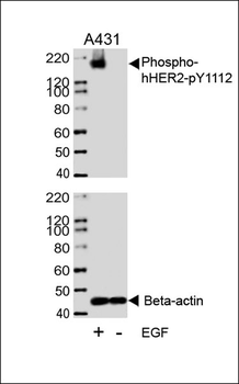 Phospho-HER2(Y1112) Antibody