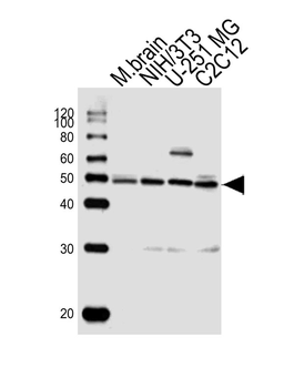 ENOA Antibody (N-term)