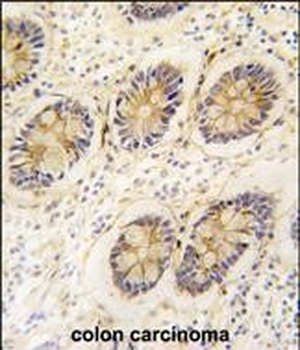 AKR1B1 Antibody (C-term)