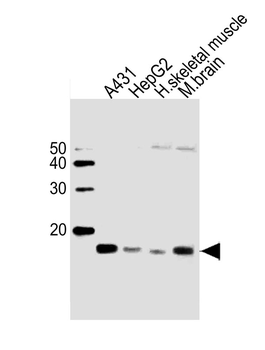 UBE2D1 Antibody (C-term)