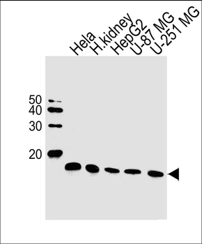 NDUFC2 Antibody (N-term)