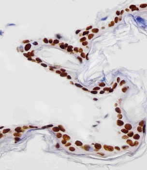 HIST1H4A Antibody (C-term)
