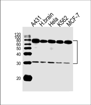 PLAUR Antibody (C-term)