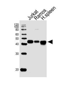 HLA-B Antibody (N-term)