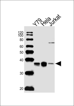PDCL Antibody (N-term)