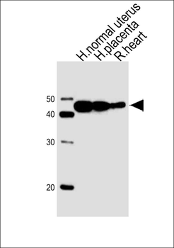ACTA1/α-actin Antibody (C-term)
