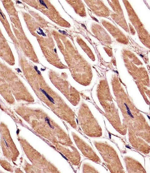 ACTA1/α-actin Antibody (C-term)
