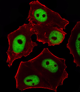 GATA3 Antibody (Center)