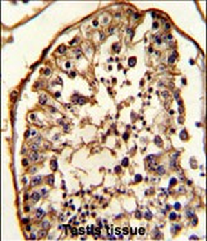 TBB5 Antibody