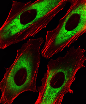 EEF1B2 Antibody (Center)