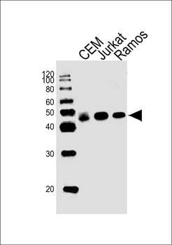HLA-C Antibody (N-term)