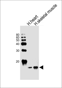 FABP3 Antibody