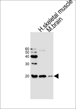 CFL2 Antibody (C-term)