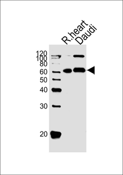 PACSIN2 Antibody (C-term)