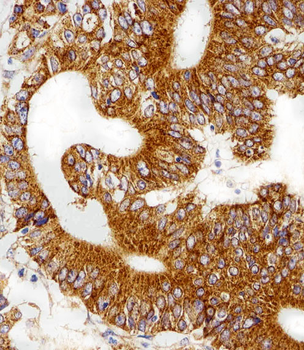 RPL6 Antibody (N-term)