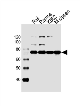 BTK Antibody (Center)