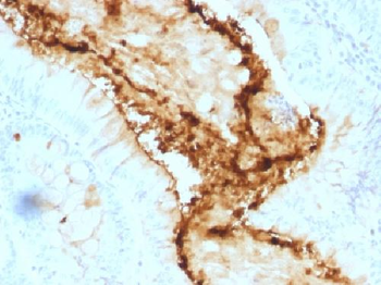 Lewis Y (Tumor Marker) Antibody