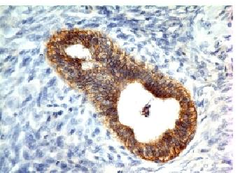 Anti-E-Cadherin / CD324 Antibody