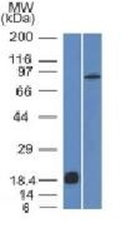 Anti-E-Cadherin / CD324 Antibody