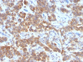 Anti-VEGI (Vascular Endothelial Growth Inhibitor) Antibody