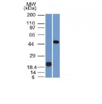 PAX8 (Renal Cell Marker) Antibody
