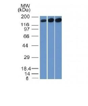 Topoisomerase II alpha Antibody