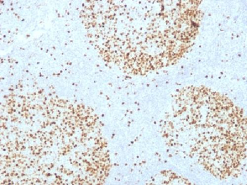 Topoisomerase II alpha Antibody