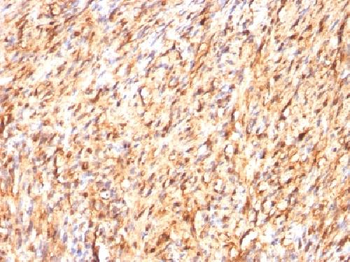 Anti-S100B Antibody