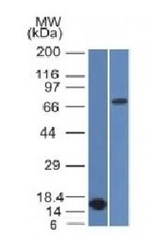 Bcl-6 Antibody