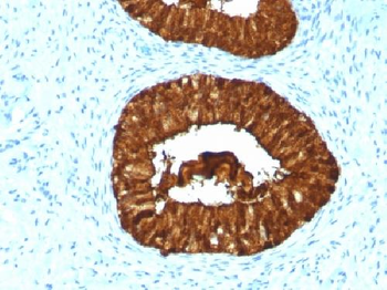 Anti-MAML3 Antibody