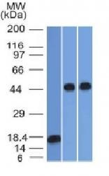 Anti-Alpha-1-Antitrypsin (SERPINA1) Antibody