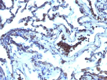 Anti-TDP2 / EAPII Antibody