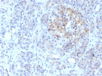 Anti-MRP1 / ABCC1 Antibody