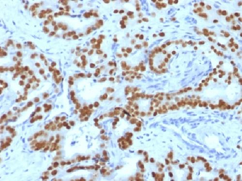 Anti-FOXA1 / HNF3A Antibody