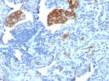 CD209 / DC-SIGN Antibody