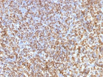 Galectin-13 (GAL13) / Placental Protein 13 (PP13) Antibody