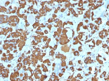 Growth Hormone Antibody
