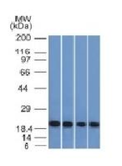 Anti-Ferritin, Light Chain (FTL) (Microglia Marker) Antibody