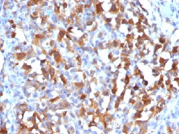 MART-1 / Melan-A / MLANA Antibody