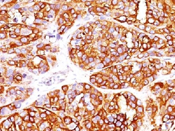 MART-1 / Melan-A / MLANA Antibody