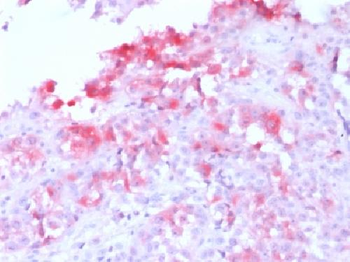 Anti-MART-1 / Melan-A / MLANA Antibody
