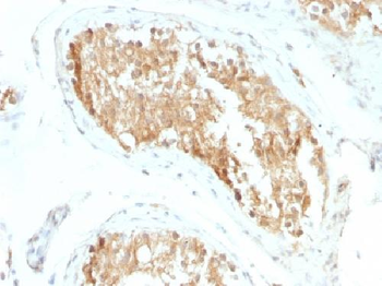 Anti-ALDH1A1 (Aldehyde Dehydrogenase 1A1) Antibody