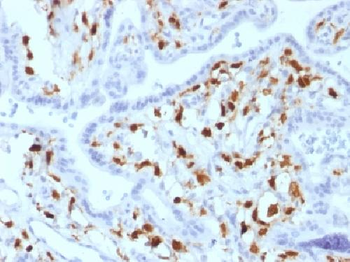 Factor XIIIa Antibody