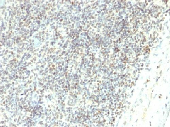ETS1 / Antibody
