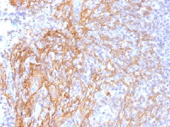 Anti-Catenin, beta (p120) Antibody