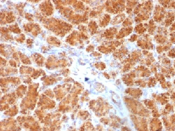 Clathrin, Light Chain Antibody