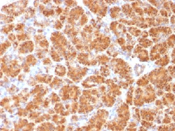 Clathrin, Light Chain Antibody