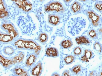 Anti-CFTR Antibody
