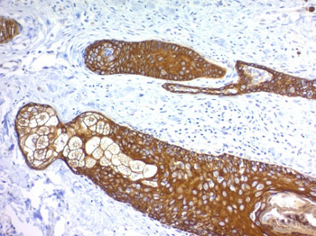 Cytokeratin, Basic (Type II or HMW) (Epithelial Marker) Antibody - With BSA and Azide